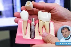 પડી ગયેલો માત્ર એક દાંત પણ તમને મોટા ખર્ચામાં ઉતારી શકે છે