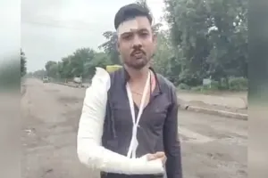 રસ્તાના ખાડાથી અકસ્માત થયો તો આ યુવાન 111 દિવસ લડ્યો, NHAI સામે ગુનો નોંધાયો