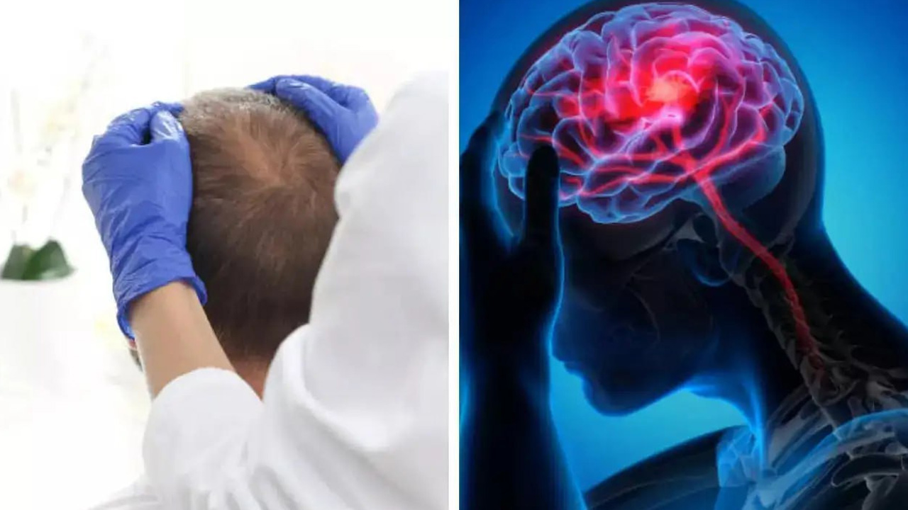 Head-Massage-Brain-Stroke2